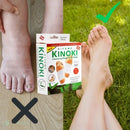 ADETÓX – Adesivo Detox para os Pés