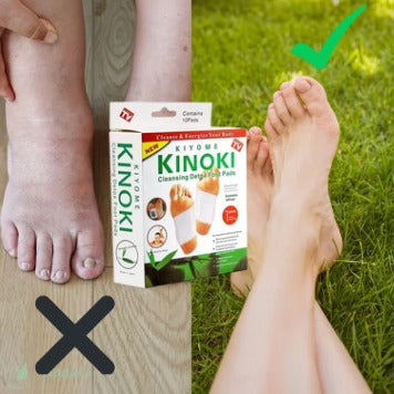ADETÓX – Adesivo Detox para os Pés